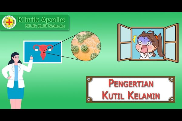 Pengertian Kutil Kelamin